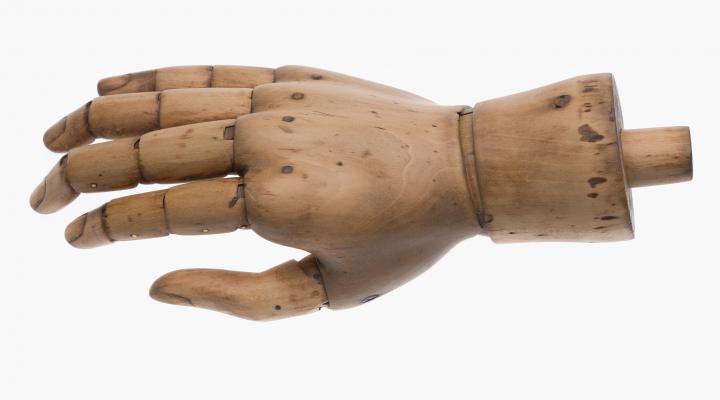 Handprothese (Handrücken)