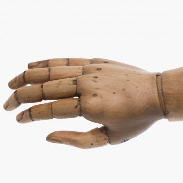 Handprothese (Handrücken)